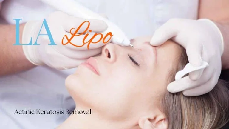 Woman receiving Actinic Keratosis Removal Treatment Sunbury-on-Thames