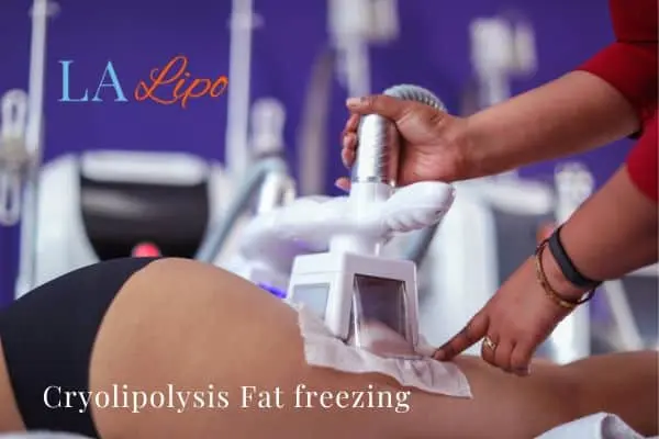 women getting fat freezing Sunbury-on-Thames