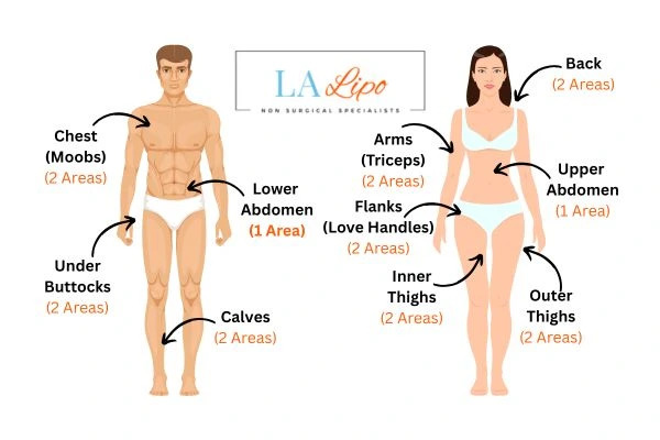 LA LIPO Cryolipolysis Areas Sunbury-on-Thames