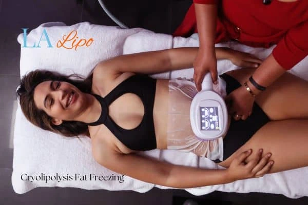 woman getting cryolipolysis Sunbury-on-Thames