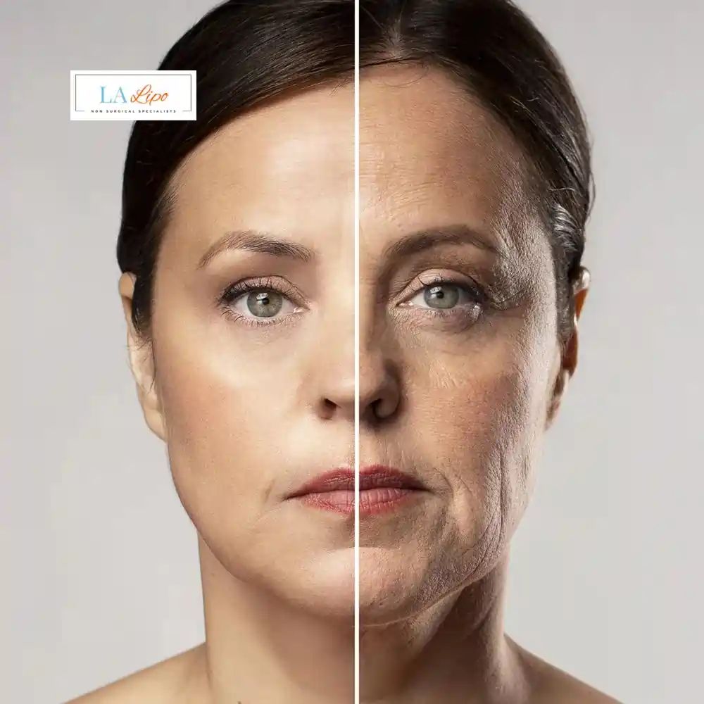 How Can You Tell If Non-Surgical Skin Tightening Is Right for You Sunbury-on-Thames?