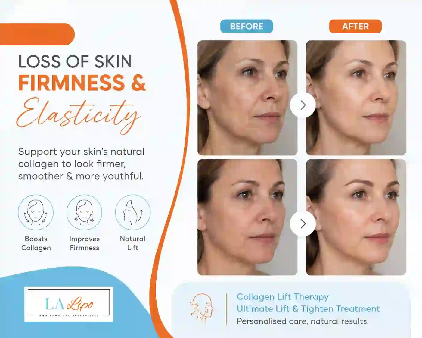 Sign #7: Loss of Skin Firmness and Elasticity Sunbury-on-Thames