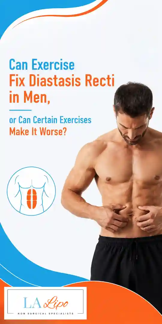 Can Exercise Fix Diastasis Recti in Men, or Can Certain Exercises Make It Worse Sunbury-on-Thames?